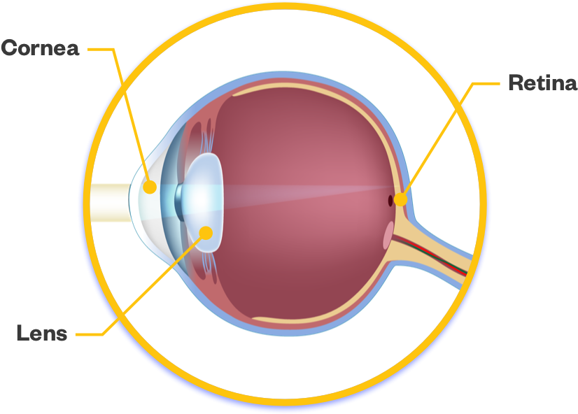 Eye without cataract